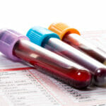 Understanding glycated haemoglobin (hba1c test) - a key indicator of diabetes control